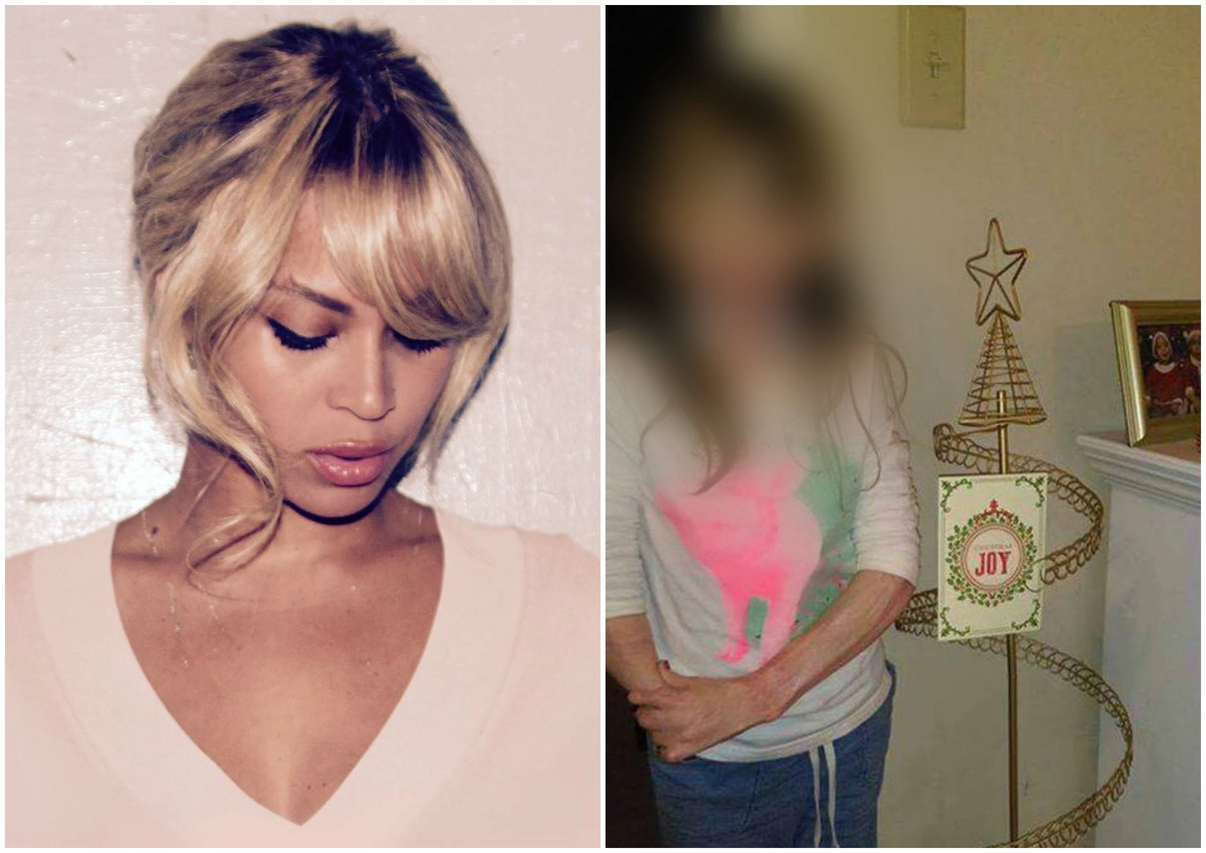 Il regalo natalizio di Beyoncé alla bambina di 8 anni sfigurata dopo un  incendio