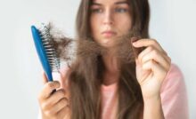 Caduta capelli